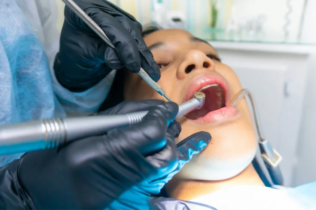 Dental procedure close-up representing dental negligence and compensation claims