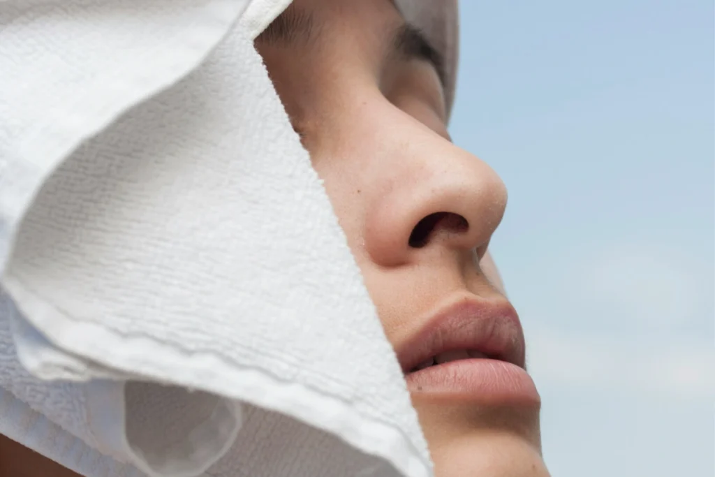 Person recovering after rhinoplasty procedure for potential negligence claim