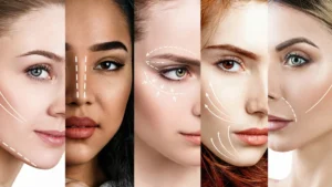 Non-surgical cosmetic treatments for facial rejuvenation — comparison of skin improvements as alternatives to plastic surgery