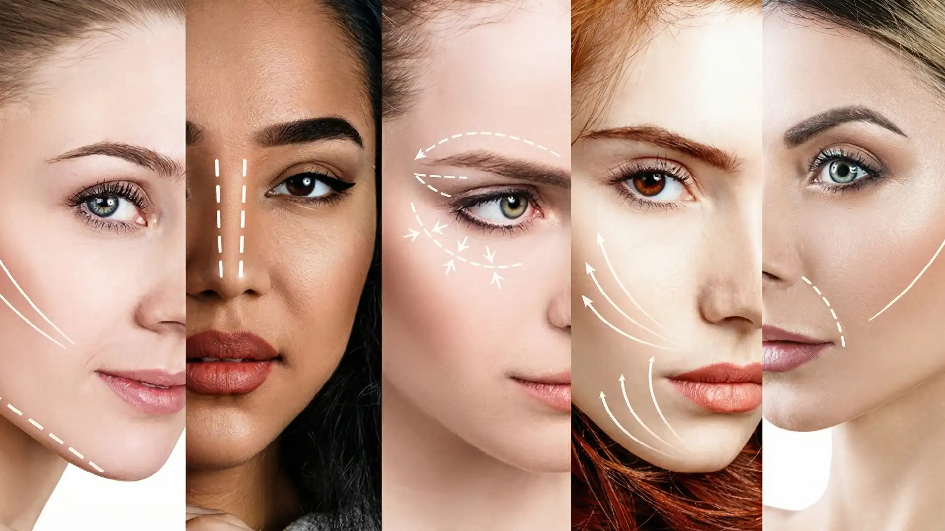 Non-surgical cosmetic treatments for facial rejuvenation — comparison of skin improvements as alternatives to plastic surgery